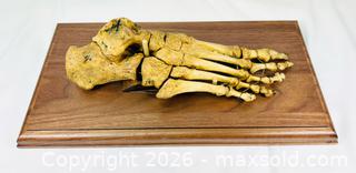 MaxSold Auction: Antique Human Foot Bone Specimen | Mounted on Wooden Base | 19th Century - Maxsold Signature - Museum-Quality Artifacts, Ancient Antiquities and Collector Finds (CAN and US Shipping)